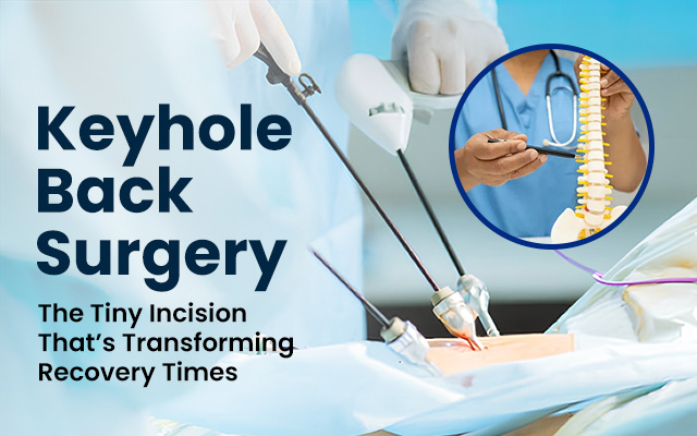 Keyhole Back Surgery: The Tiny Incision That’s Transforming Recovery Times